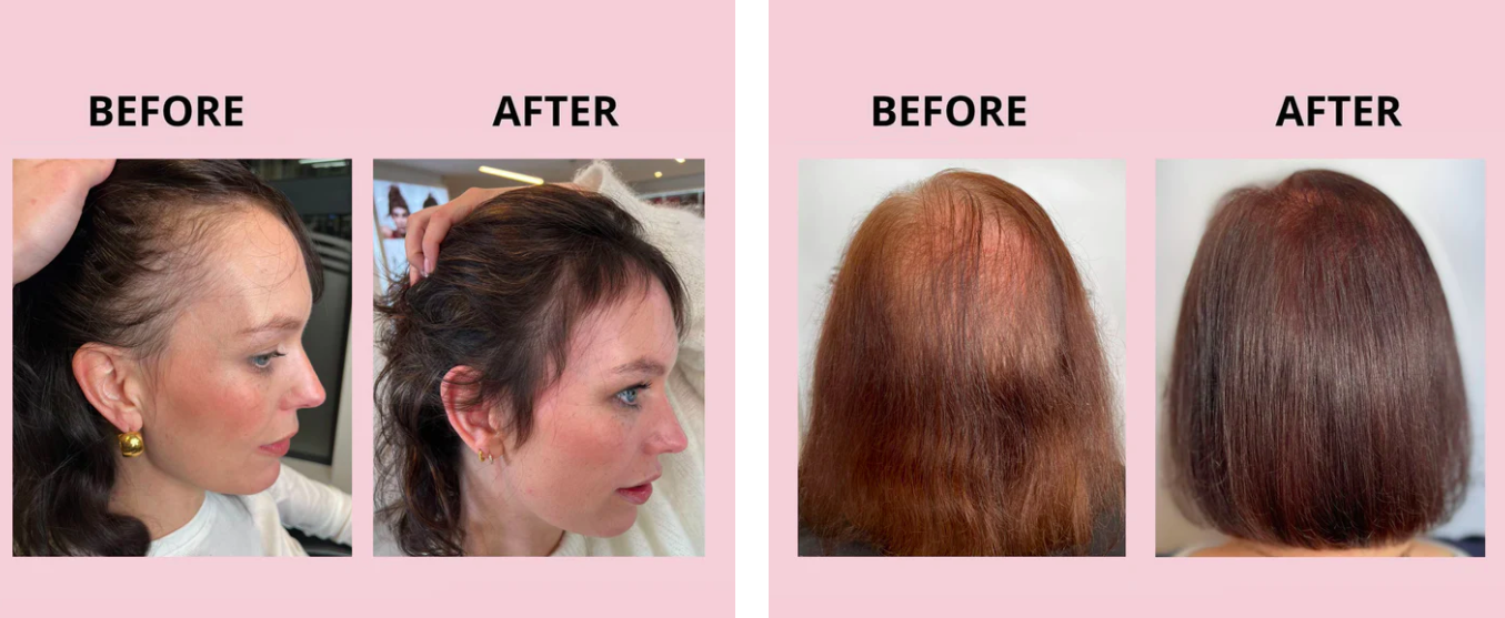 GLOWWA Hair Food Best Hair Supplements Bexleyheath