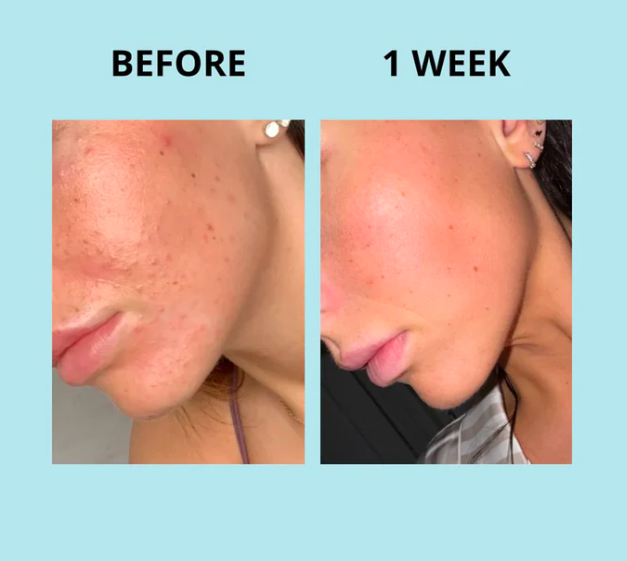 GLOWWA Collagen supplement before and after